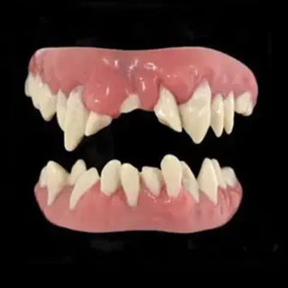 Monster Teeth – Pro FX Veneers