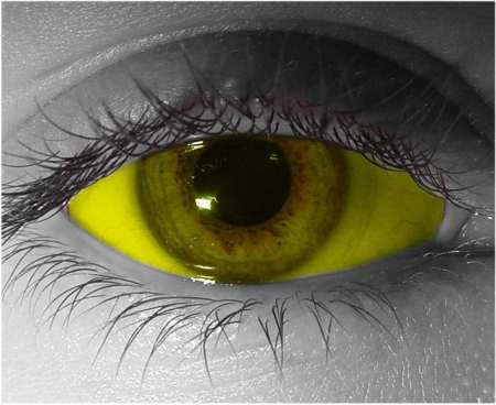 Yellow Sclera Contact Lenses 22mm - Gothika Custom - Pair